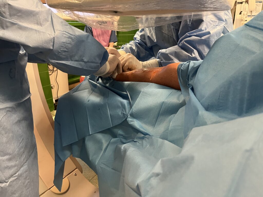 odsłonięta ręka pacjenta, na której dwie osoby z personelu medycznego prowadzą zabieg, widać tylko ich dłonie