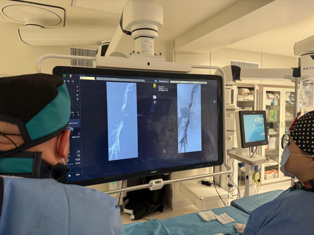 stół operacyjny, nad nim duży ekran, stoją dwie osoby prowadzące zabieg